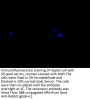 NPPB Antibody