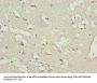 Rabbit anti-human NT-proBNP polyclonal Antibody