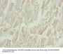 Rabbit anti-human NT-proBNP polyclonal Antibody