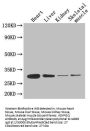 Rabbit anti-human Adiponectin polyclonal Antibody