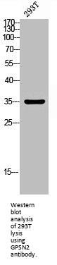 GPSN2 Polyclonal Antibody