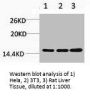 Tri-Methyl-Histone H3 (Lys36) Antibody