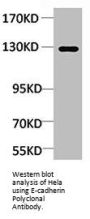 CDH1 Antibody