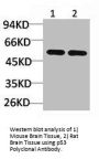 TP53 Antibody