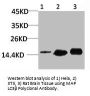 MAP1LC3B Antibody