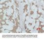 PIK3R1 Antibody