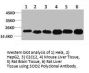 SOD2 Antibody