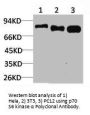 RPS6KB1 Antibody