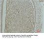 ACTN1 Antibody