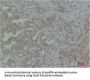 STAT3 Antibody