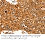 SERPINB5 Antibody