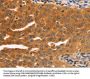 SERPINB5 Antibody