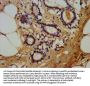 LTBR Antibody