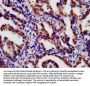 LTBR Antibody