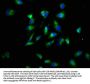 LTBR Antibody