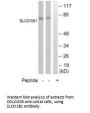 SLCO1B1 Antibody