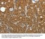 SKP1 Antibody