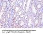 TNFRSF10D Antibody