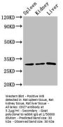 CD27 Antibody