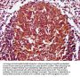 CD27 Antibody