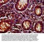 CD27 Antibody