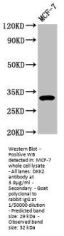DKK2 Antibody