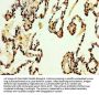 DKK2 Antibody