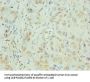 CXCL8 Antibody