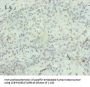 CXCL8 Antibody