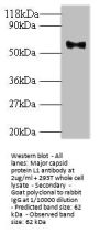 L1 Antibody