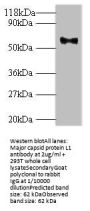 L1 Antibody