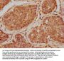 IGF1 Antibody