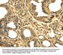 Rabbit anti-human RPS3 polyclonal antibody