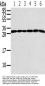 Rabbit anti-human RPS3 polyclonal antibody