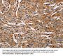 ACTA1 Antibody