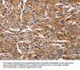 ACTA1 Antibody