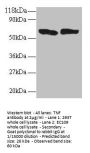 TNF Antibody