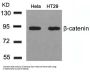 CTNNB1 (Ab-41/45) Antibody