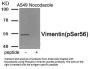 Phospho-VIM (Ser56) Antibody