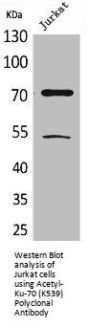 Acetyl-XRCC6 (K539) Antibody