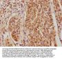 CSNK2A3 Antibody