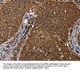 DCP1A Antibody