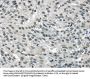 MED15 Antibody