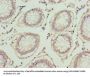 PLA2G7 Antibody