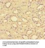 CCL14 Antibody