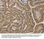 MVK Antibody
