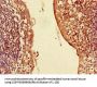 CXCL3 Antibody