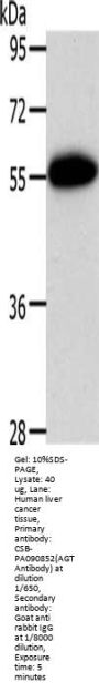 AGT Antibody