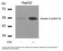 Phospho-KRT8 (Ser74) Antibody