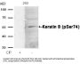 Phospho-KRT8 (Ser74) Antibody